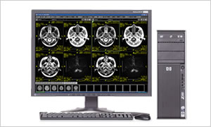 画像：画像診断ワークステーション